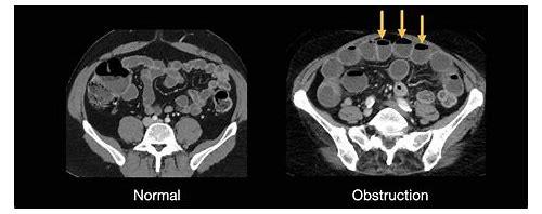 备孕期间为何要远离CT检查？科学解析辐射风险与健康选择