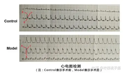 备孕期间能否做磁共振？科学解析与实用指南