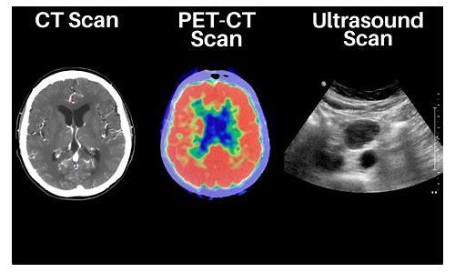 备孕期间为何要远离CT检查？科学解析辐射风险与健康选择