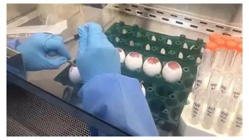 男子备孕检查：为优生优育筑牢健康防线