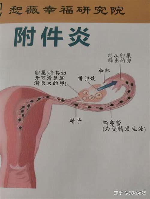 怀孕是不是情绪不好？解析孕期情绪波动的真相与应对之道